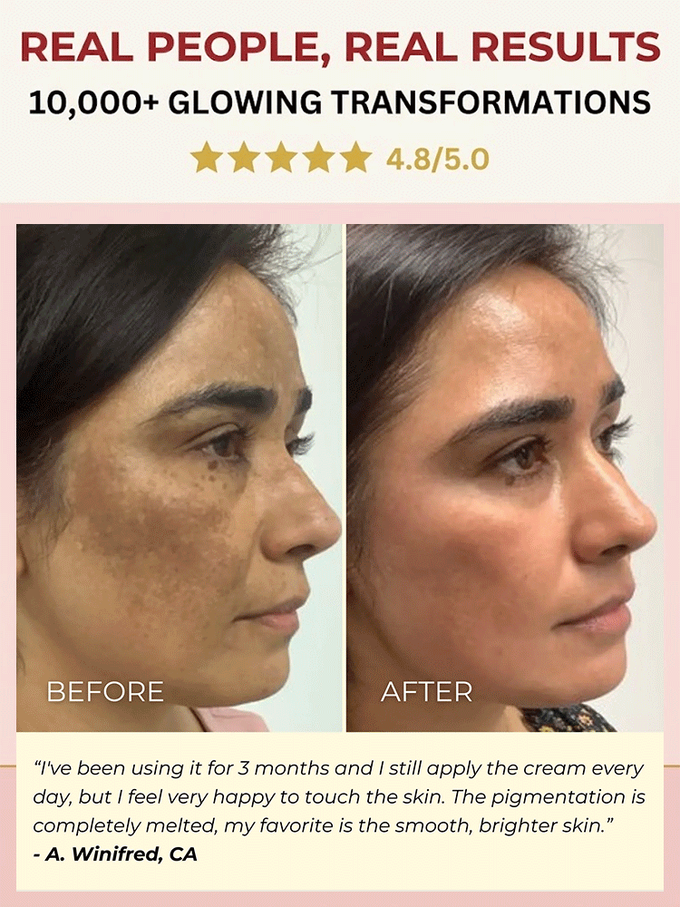 [3-in-1] Whitening, Spot-Correcting, and Anti-Wrinkle Serum