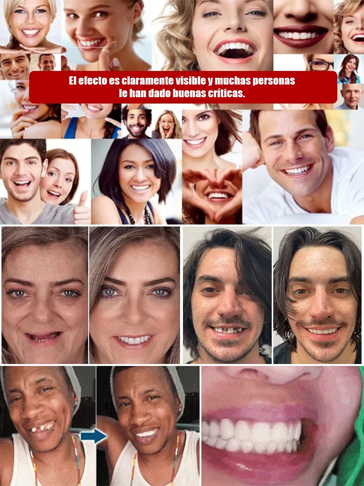 [Recomendación del dentista] Las dentaduras postizas cómodas sostienen la estructura facial