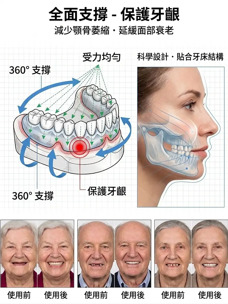 【完美貼合臉型】自適應全包假牙套