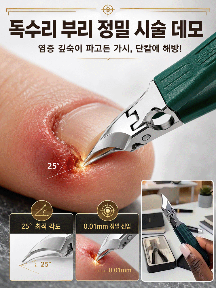 【장마철 대비】내성 발톱 전용 네일 클리퍼