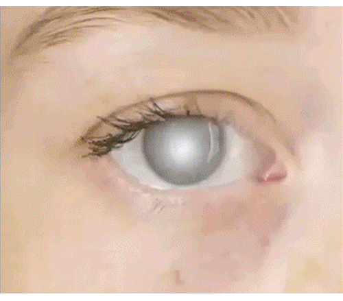 f852010124c30c5f9da3b19cd71a1793.gif