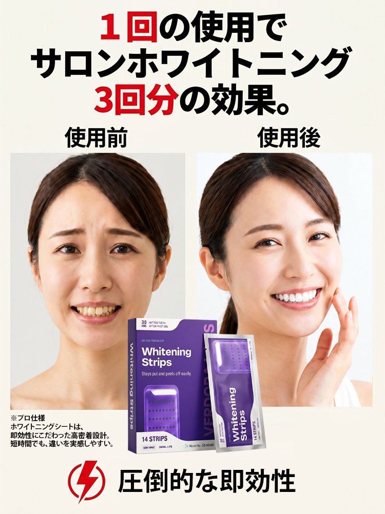 牙齿美白_25.jpg
