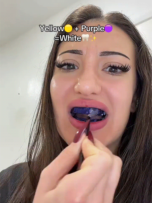[Visible Results After One Use] No More Repeated Whitening Strips