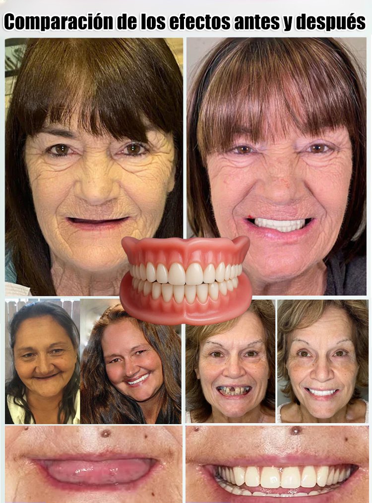 Prótesis dentales completas y cómodas, con un ajuste natural