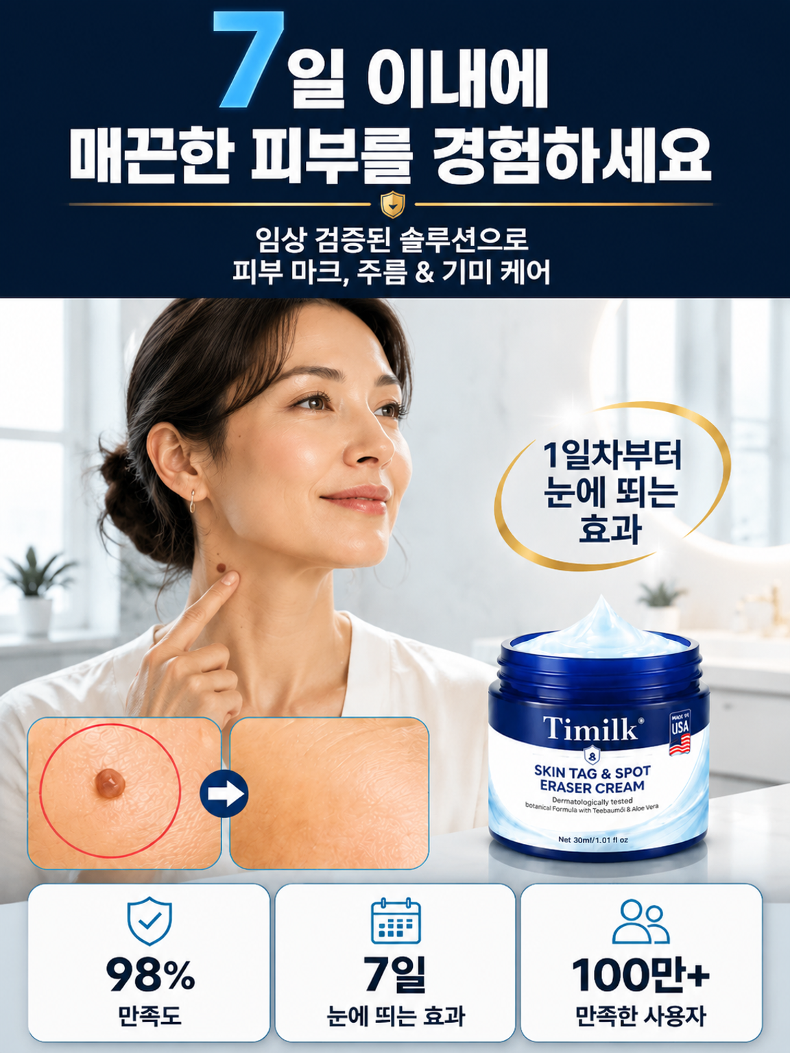 7일 피부 사마귀 제거 크림