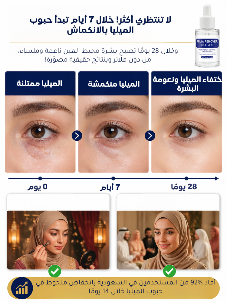 سيروم للعناية بحبوب الميليا حول العينين