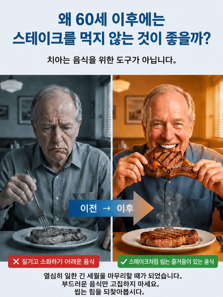 【영원한 미소】 강력 흡착 의료용 올커버 의치