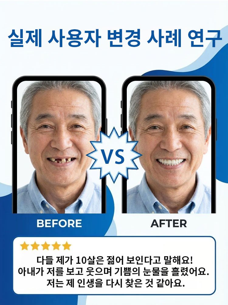 【전미 베스트셀러】고급 의료용 의치 세트
