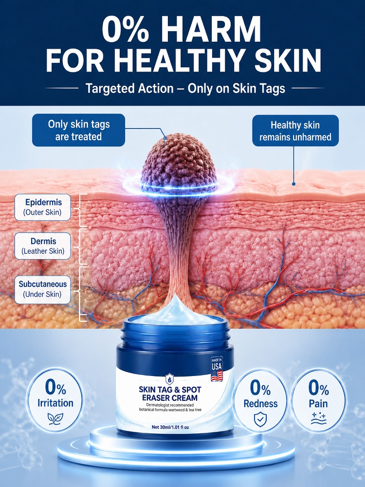 7 Days Fast Skin Growth Remover Cream