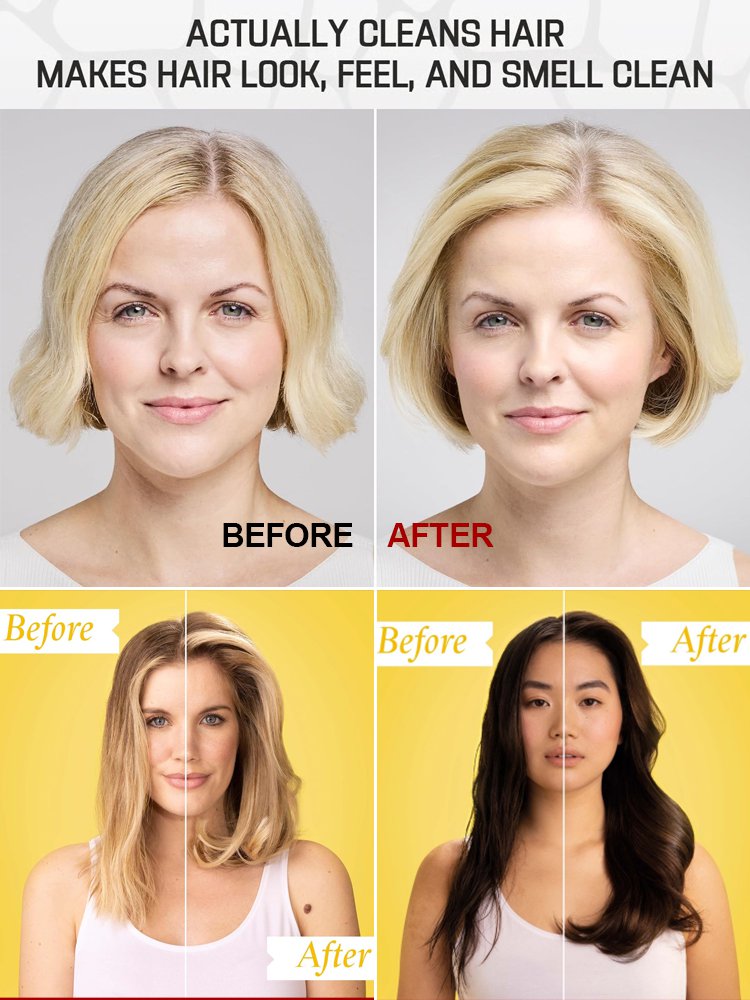  No-rinse dry hair oil control spray to keep hair fresh and fluffy