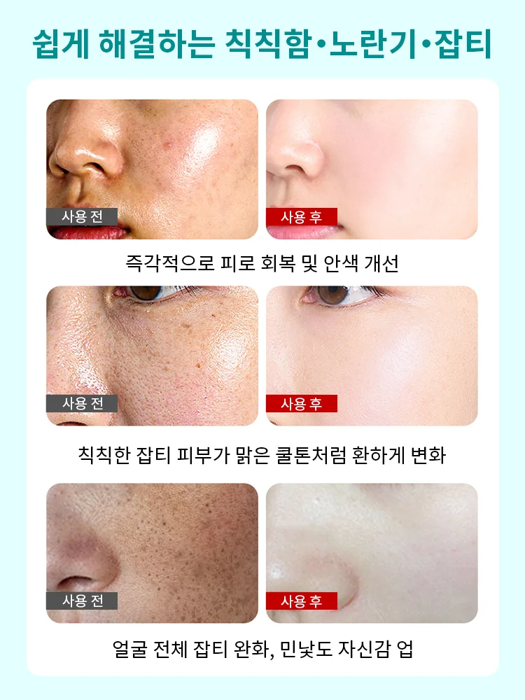 잡티 제거 및 미백 필오프 마스크