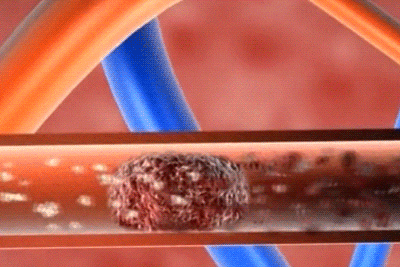 1.gif