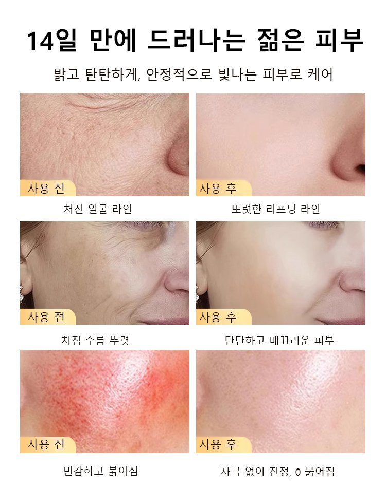 【한 병으로 동안 완성】주름 개선 앰플