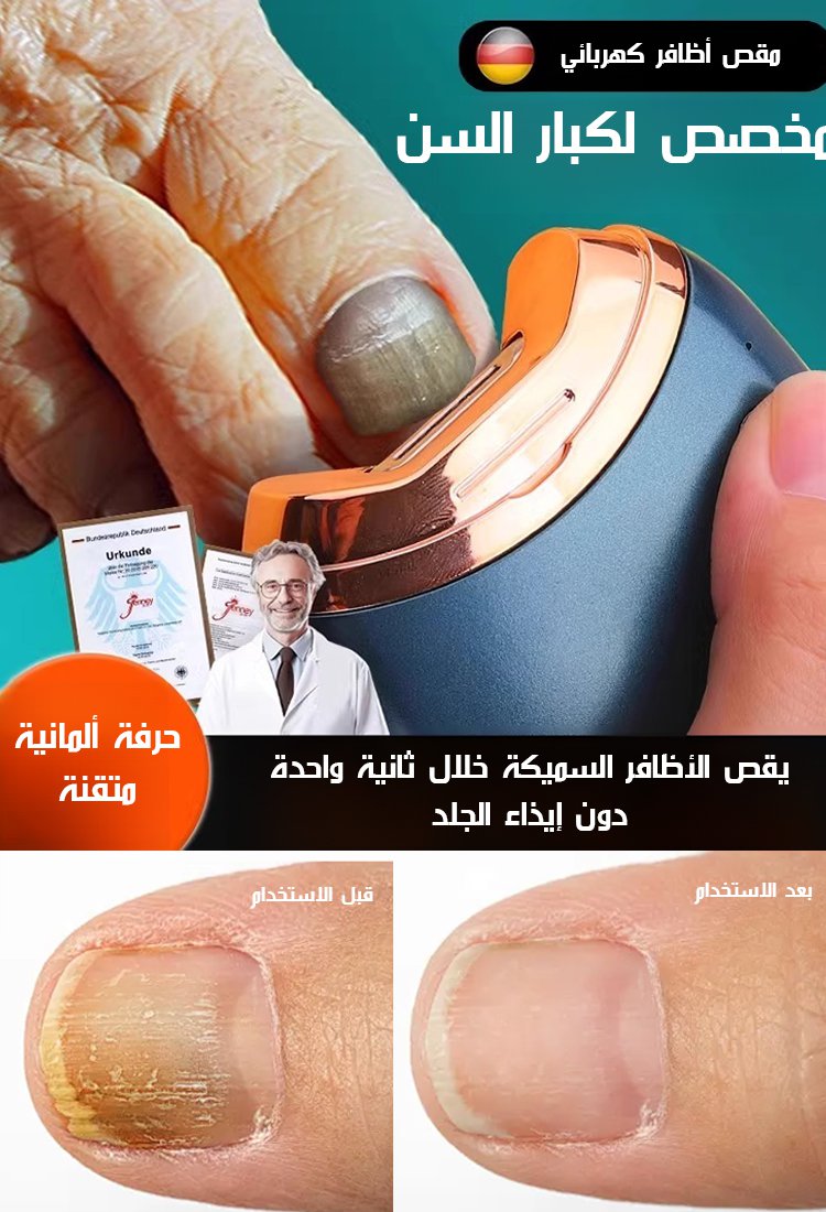 HFH-【الألمانية الدقيقة】مقص أظافر كهربائي