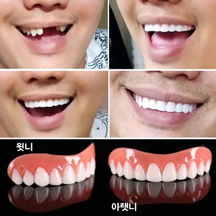 Snapon Smile 미백 치아교정기