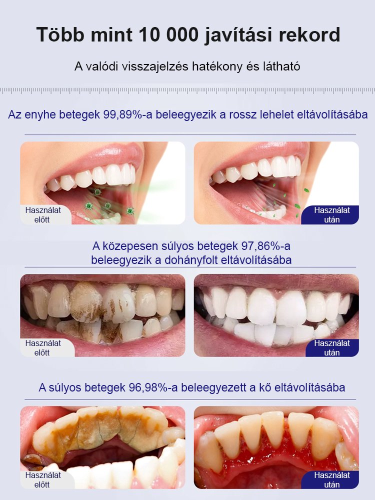 【3 nap alatt eltávolítja a fogkövet】Hidroxiapatit fogkrém