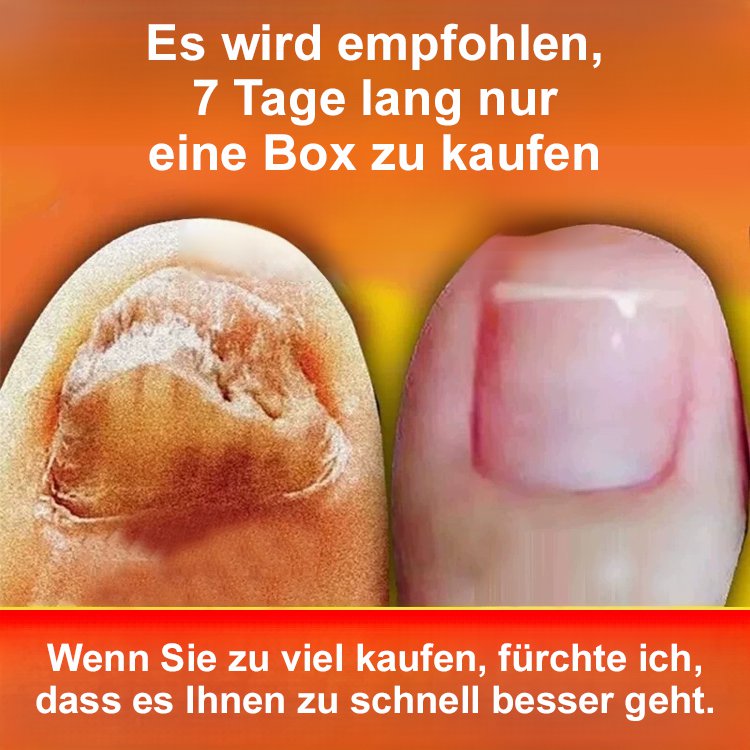 [Schmerzlos und kein Wiederauftreten] Onychomykosesalbe