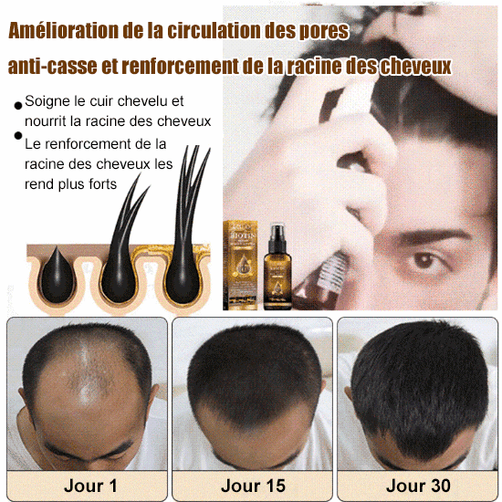 Spray de croissance capillaire à la biotine