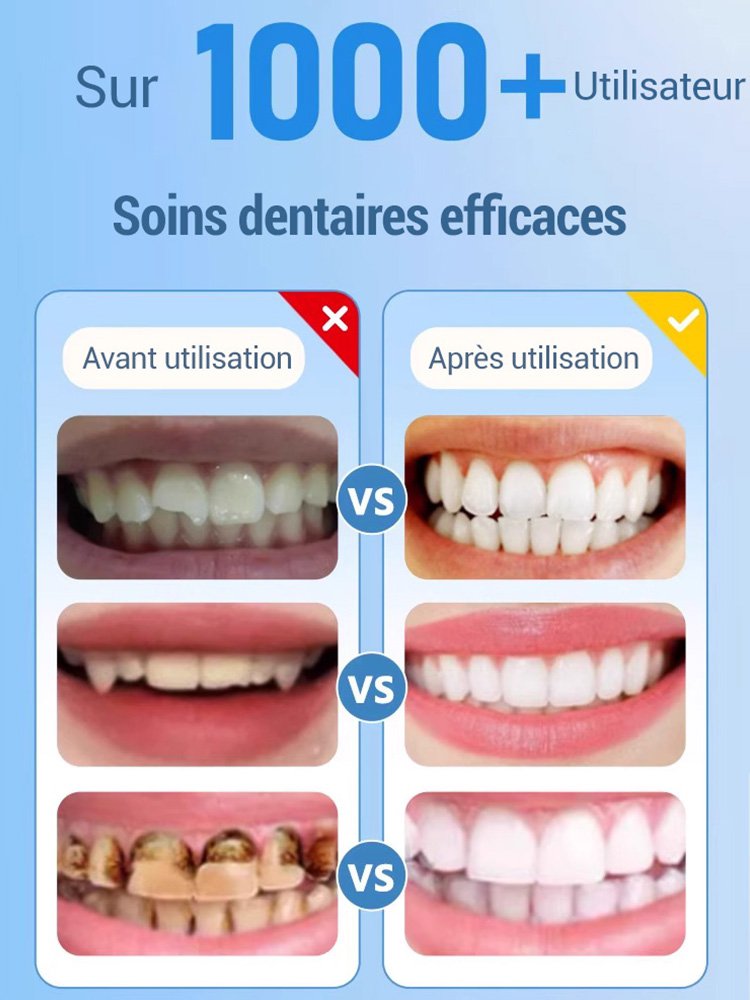Lifting sourire prothèse silicone set