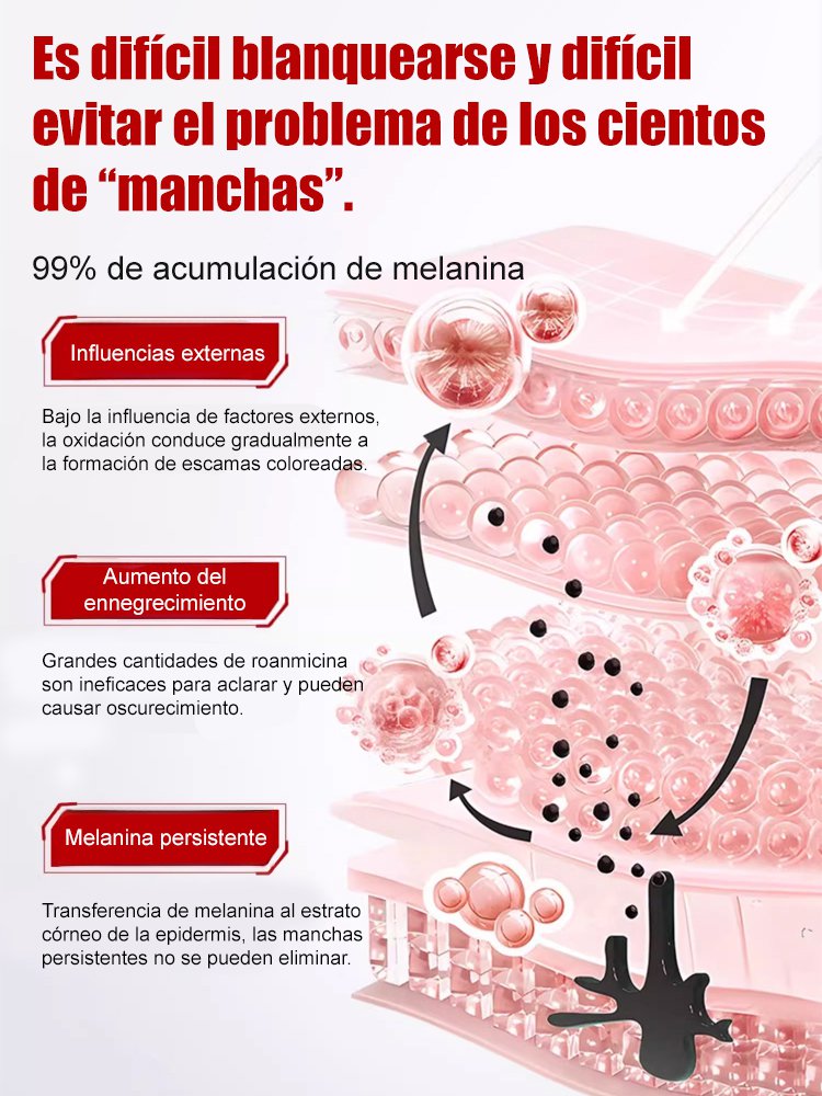 【Spray para eliminar todo tipo de manchas】Spray blanqueador y removedor de manchas