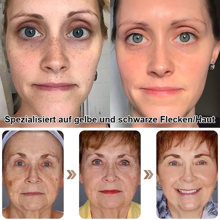 【Tiefenreinigung ohne Reizung】Geeignet für empfindliche Haut - Aufhellende Peel-Off-Maske