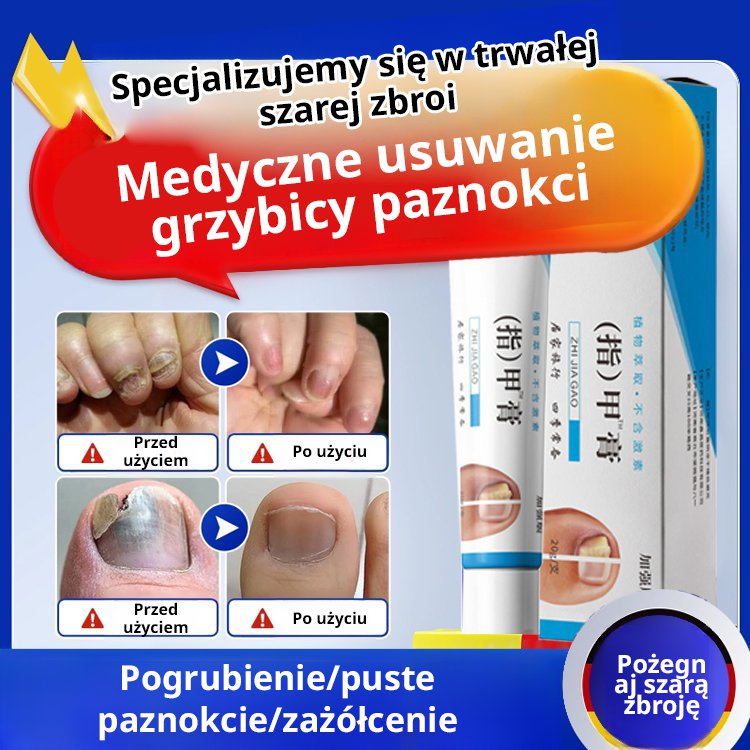 [Bezbolesne i bez nawrotów] Maść na grzybicę paznokci