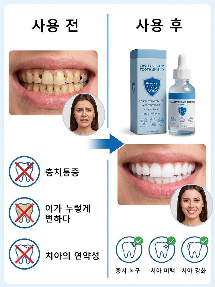 정상 국립대 개발 치아 회복액, 병원·시술 없이 하루 몇 방울로 충치 회복과 시린 이 완화!