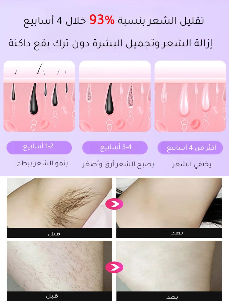 آلة أمريكية لإزالة شعر الجسم بالليزر【الدفع عند الاستلام】