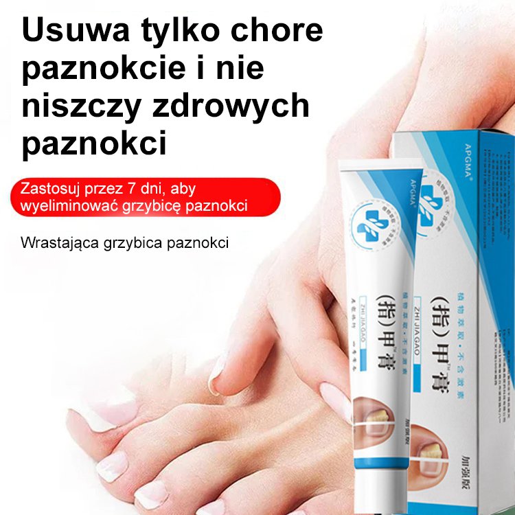 [Bezbolesne i bez nawrotów] Maść na grzybicę paznokci
