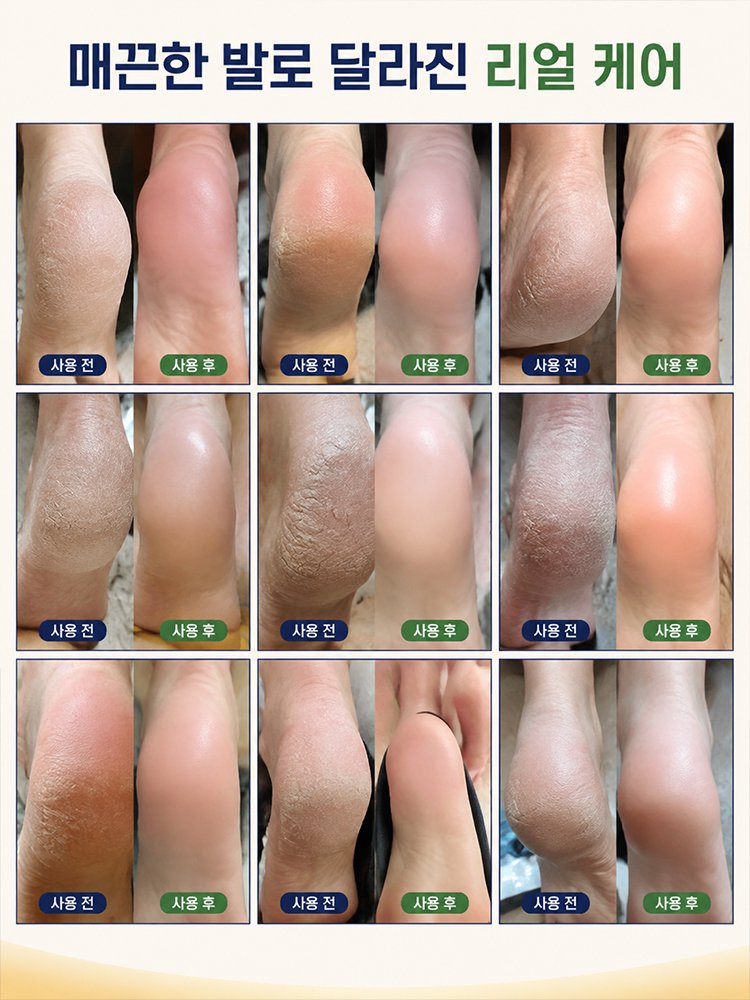 양면 홈케어 발 각질 제거기