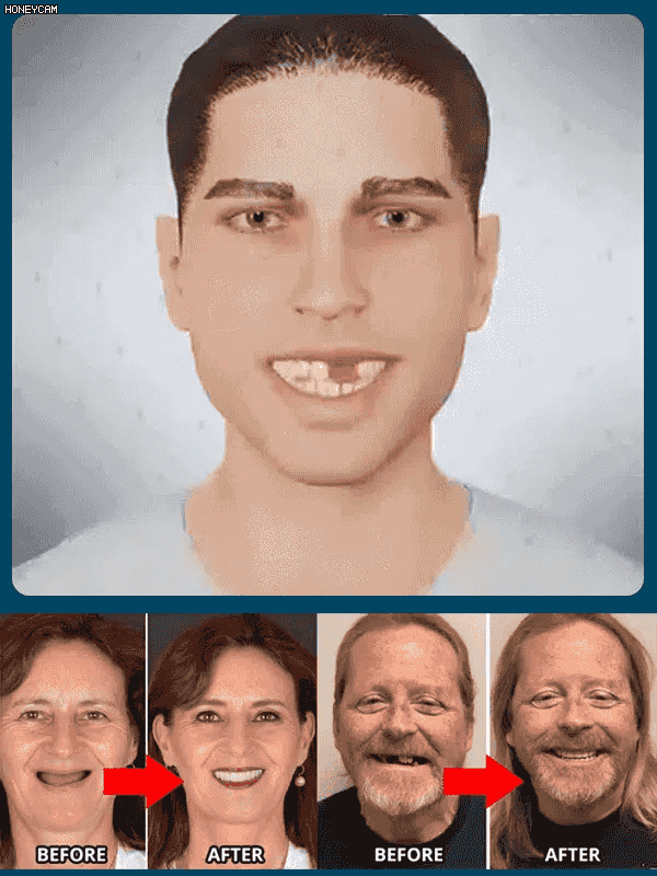 【Oficiální americké doporučení】Zubní protézy Perfect Smile