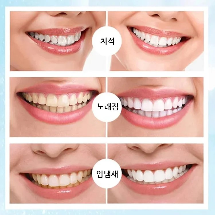 HBESTY  치아 미백 펜