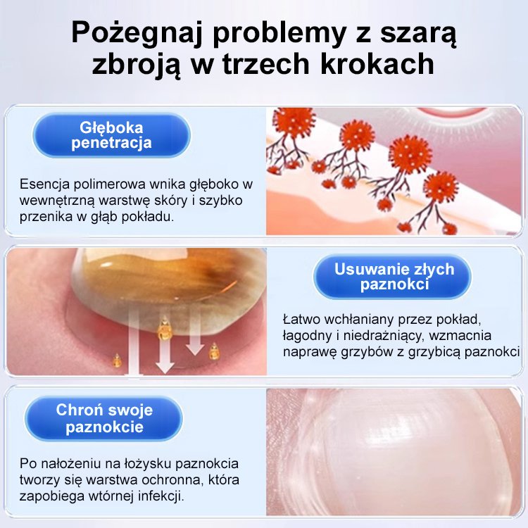 [Bezbolesne i bez nawrotów] Maść na grzybicę paznokci