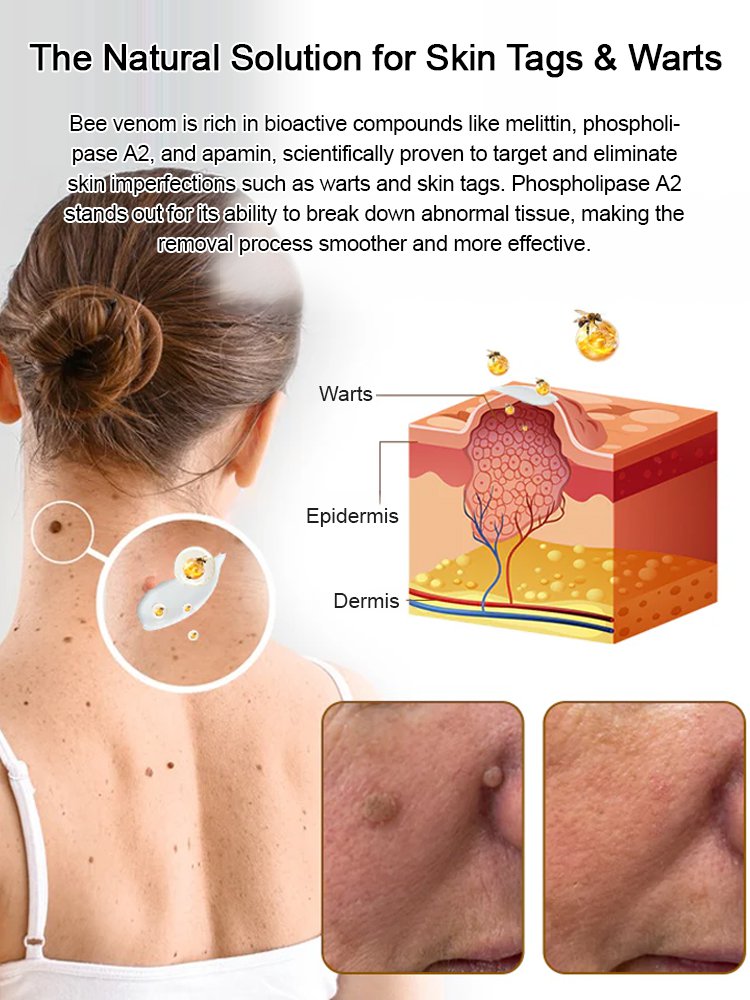 Bee venom skincare cream