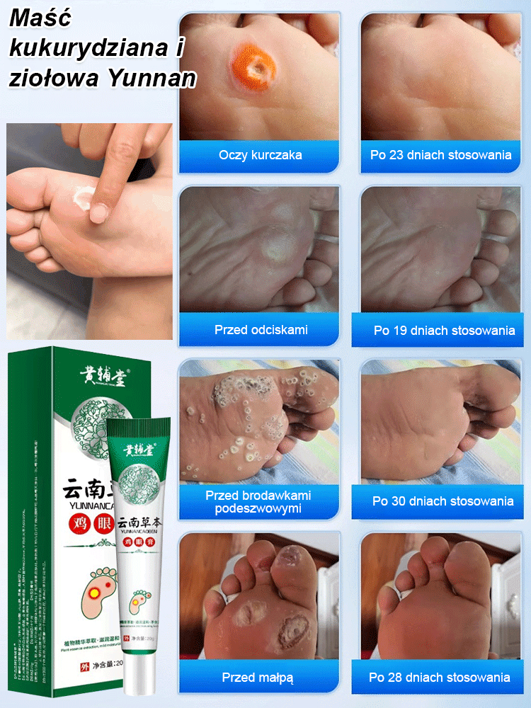 7-dniowy bezbolesny ziołowy krem do usuwania modzeli