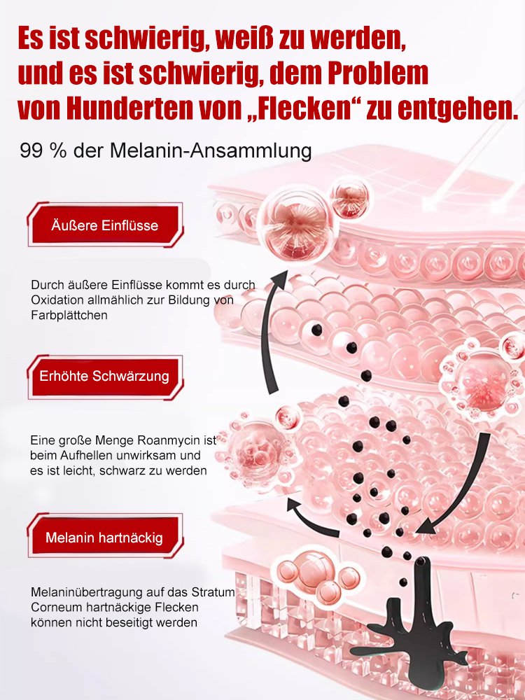 【Verschiedene Flecken - Ein Sprühstoß entfernt alles】Aufhellendes Anti-Flecken-Spray