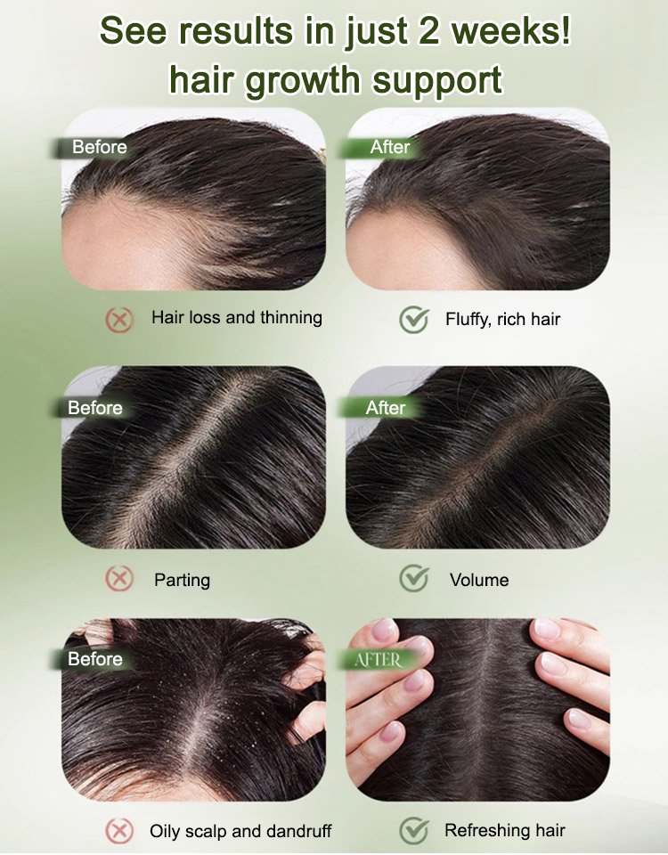 Platycladus Leaf & Usman Herb Anti-Hair Loss Solid Shampoo