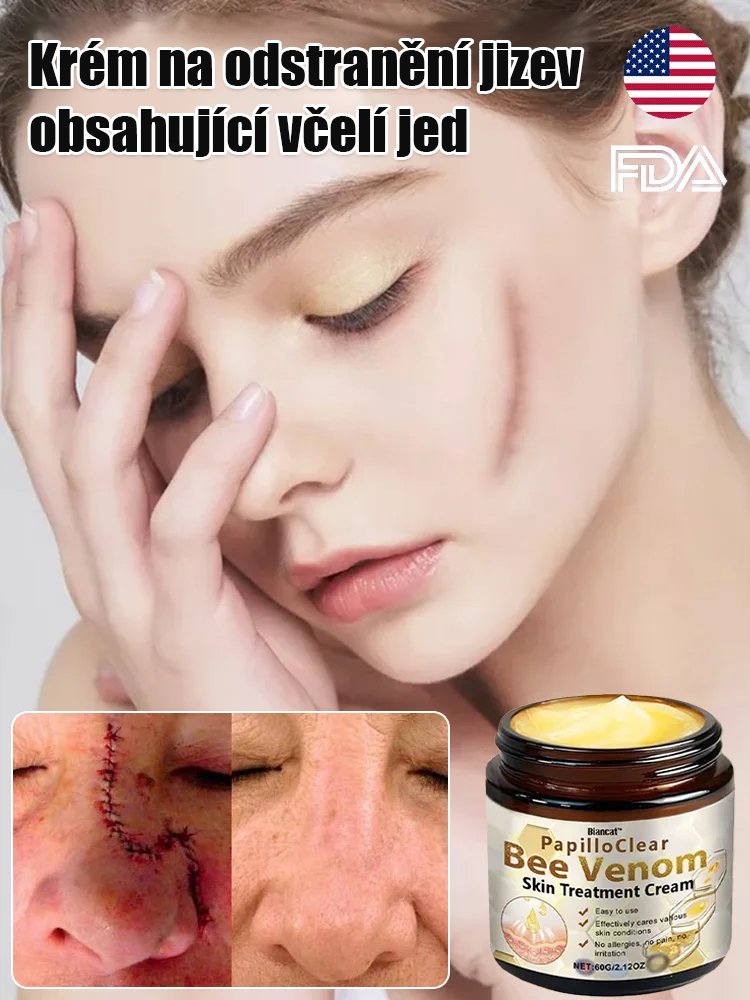 Včelí jed krém na vyhlazení jizev na pokožce
