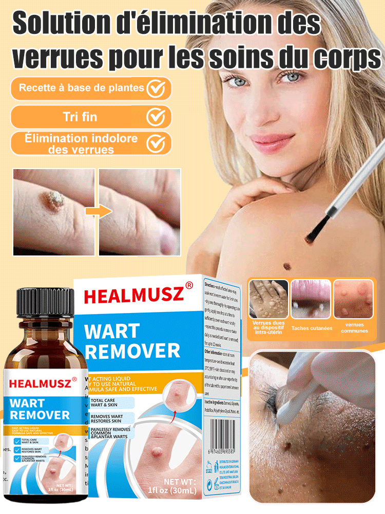 Solution pour éliminer les verrues corporelles