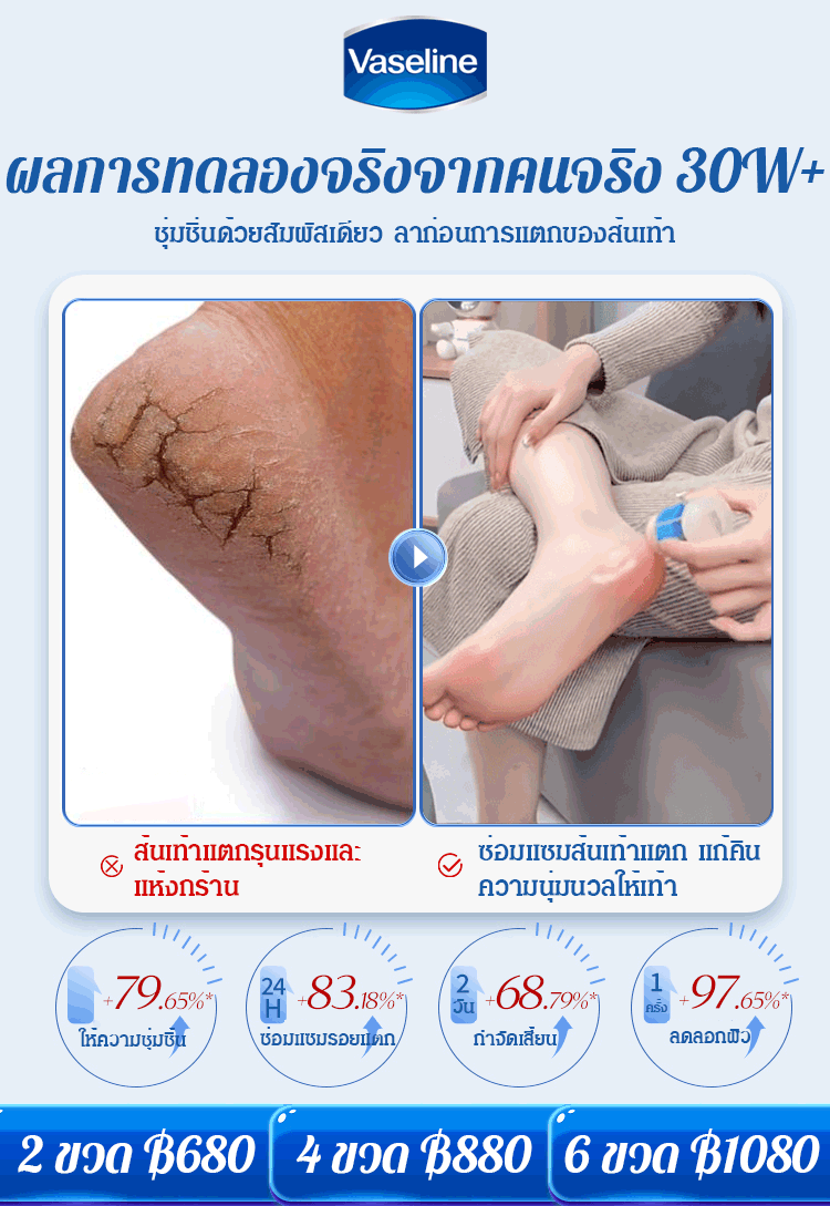 ครีมวาสลีนทามือและส้นเท้าแตก