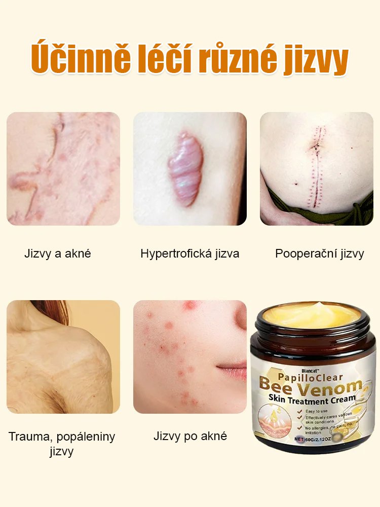 Včelí jed krém na vyhlazení jizev na pokožce