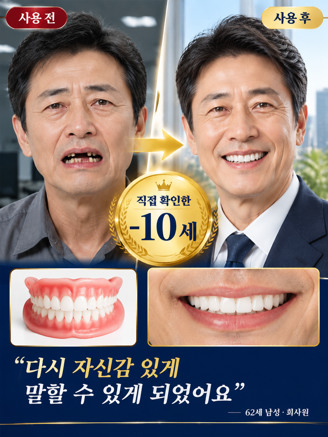 프리미엄 맞춤형 전체 틀니 세트