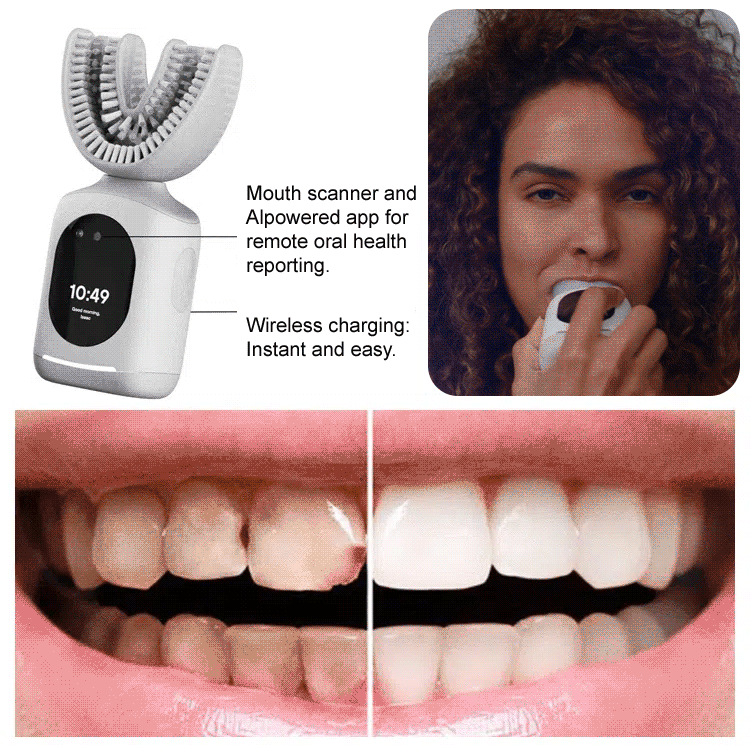 [Dentist development] 10-second fully automatic lazy U-shaped electric toothbrush