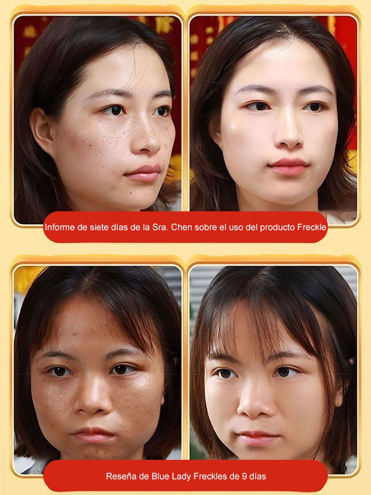 【Spray para eliminar todo tipo de manchas】Spray blanqueador y removedor de manchas