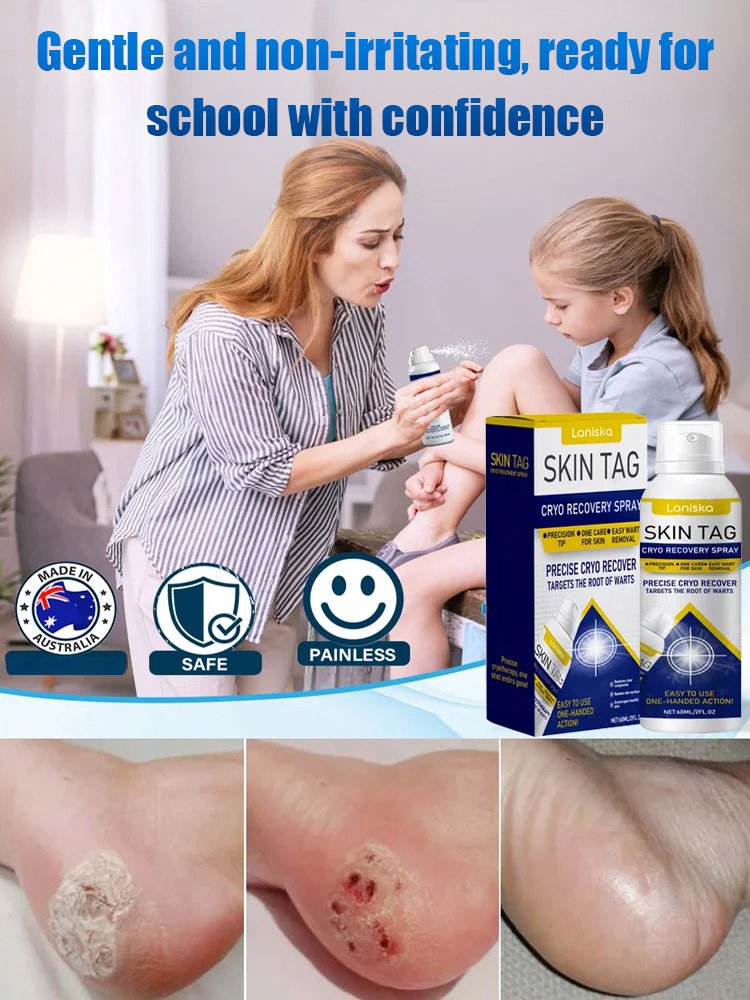 LANISKA Wart Care Topical Spray