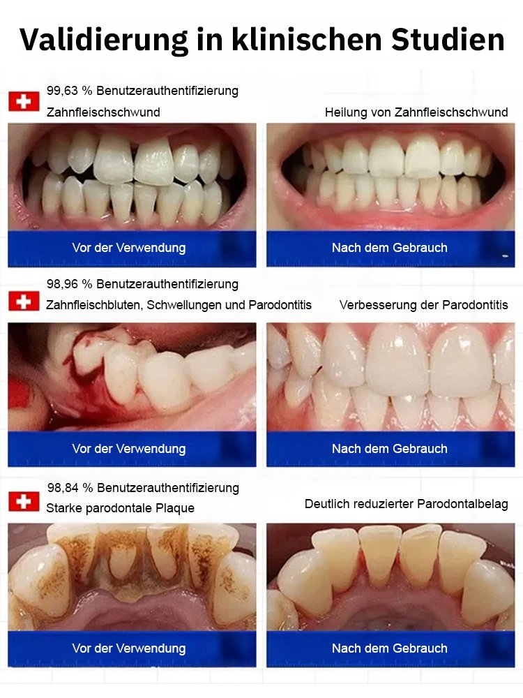 Zahnerneuerung Brausetabletten