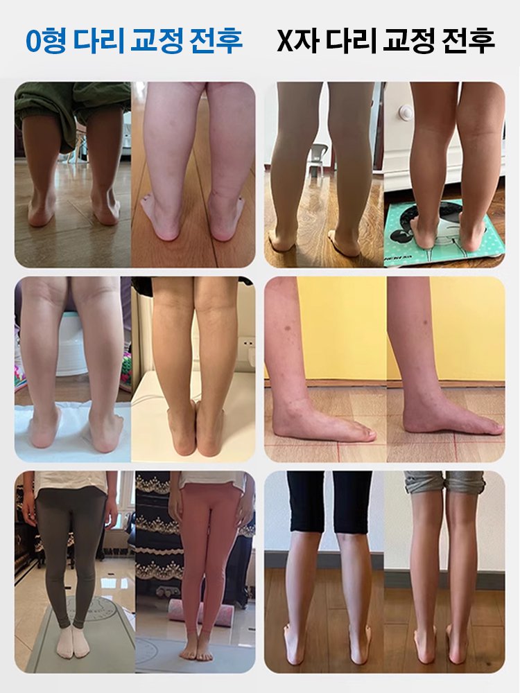 편안한 아치 지지 썸머 샌들