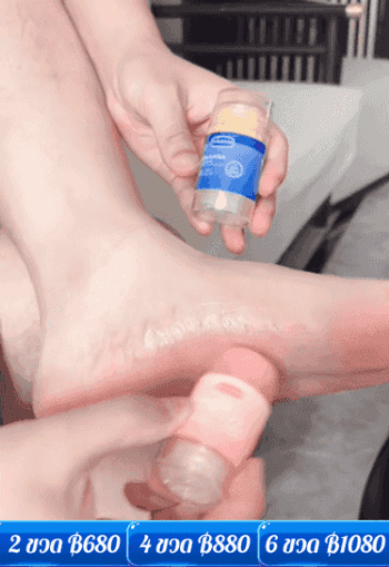 ครีมวาสลีนทามือและส้นเท้าแตก