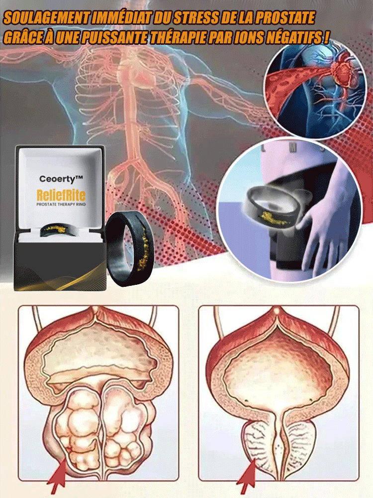 Anneau de traitement de la prostate à motif gaufré