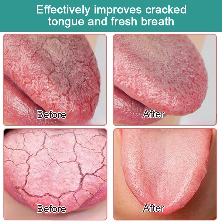 EELHOE Fresh Breath Oral Care Essence